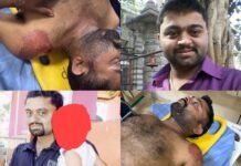 ಚಿಕ್ಕಮಗಳೂರು : ಸಾವಿನಲ್ಲೂ ಸಾರ್ಥಕತೆ ಮೆರೆದ ನೊಂದ ಕುಟುಂಬ – ಗಂಡನ ಸಾವಿನ ನೋವಲ್ಲೂ ಅಂಗಾಂಗ ದಾನಕ್ಕೆ ಮುಂದಾದ ಪತ್ನಿ